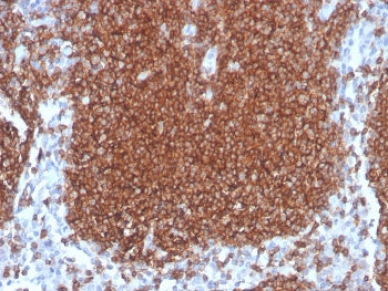 IHC staining of FFPE human lymph node with recombinant CD19 antibody. HIER: boil tissue sections in