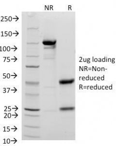CD48 Antibody (Pan Leukocyte Marker)