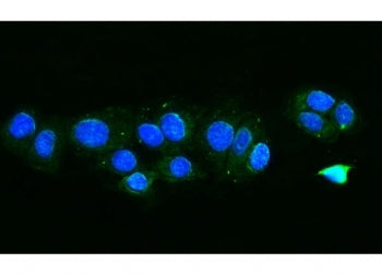 FIS1 Antibody / TTC11