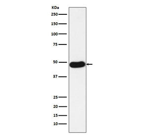 Western blot testing of human lung adenocarcinoma lysate with Napsin A antibody. Expected molecular