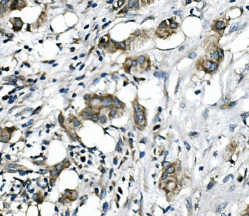 RICTOR Antibody