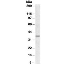 UCP2 Antibody
