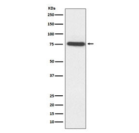 TAK1 Antibody / MAP3K7