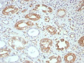 FGF-23 Antibody / Fibroblast Growth Factor 23