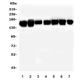 SMARCAD1 Antibody