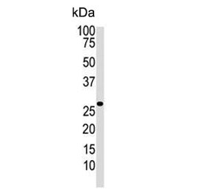 DKK2 Antibody / Dickkopf-2