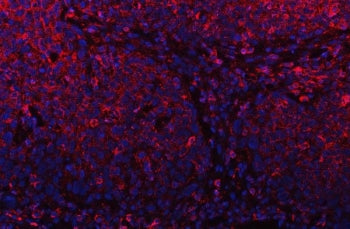 Mitochondrial phospholipase Antibody / MitoPLD / PLD6