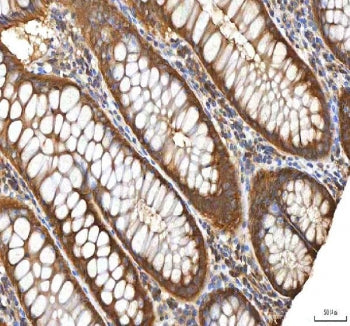 IHC staining of FFPE human colon tissue with EIF3B antibody. HIER: boil tissue sections in pH8 EDTA