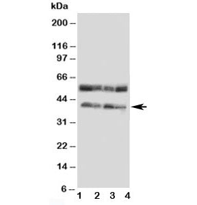 Western blot testing of CCR5 antibody and Lane 1: COLO320; 2: MCF-7; 3: SMMC-7721; 4: Jurkat cell ly