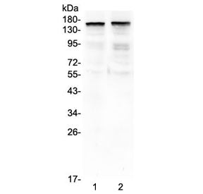 Thrombospondin 2 Antibody / THBS2