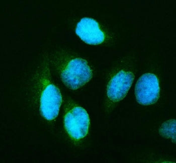 p65 Antibody NF-kB
