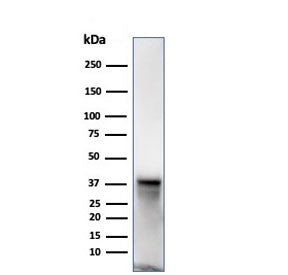 Western blot testing of human JEG-3 cell lysate using SPARC antibody (clone OSTN/3932). Expected mol
