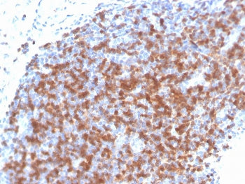 IHC staining of FFPE human tonsil with recombinant ZAP70 antibody. HIER: boil tissue sections in pH