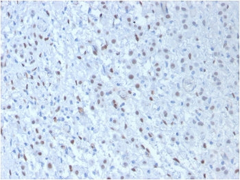 WT1 Antibody Cocktail / Wilms Tumor 1