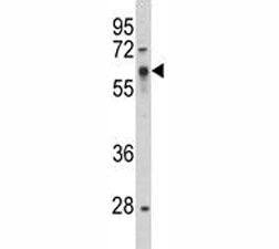 Western blot analysis of Src antibody and HepG2 lysate. Predicted size 55~60 kDa