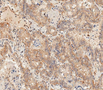 DLL3 Antibody