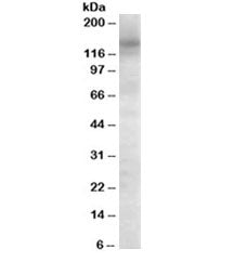 AS160 Antibody