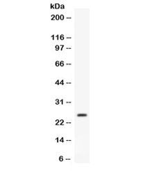 APOA1 Antibody / Apolipoprotein A I