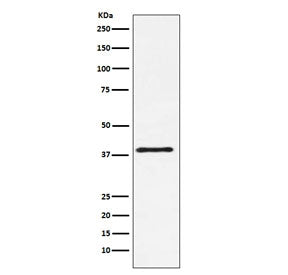 CTLA-4 Antibody / CD152