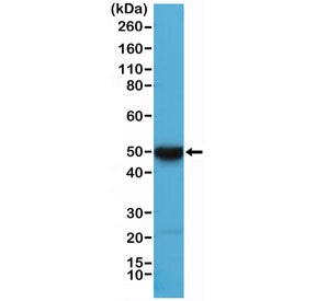 Recombinant Cytokeratin 17 Antibody