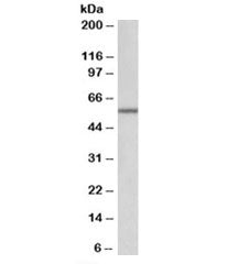ALDH6A1 Antibody
