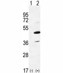 IRAK4 Antibody