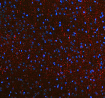 Immunofluorescent staining of NF-M/NEFM using anti-NEFM antibody (red). NF-M/NEFM was detected in a