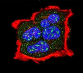 TSC2 Antibody (phospho-S1420)