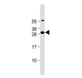 FAM125A Antibody (N-Terminal Region)