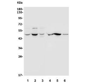 Western blot testing of human 1) A549, 2) PC-3, 3) U-2 OS, 4) rat kidney, 5) rat spleen and 6) mouse spleen lysate with ACTR3 antibody. Predicted molecular weight ~47 kDa.