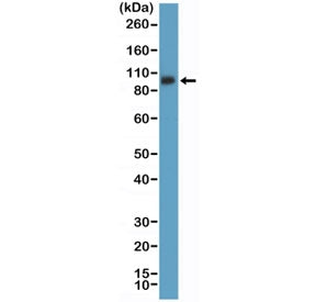 CD61 Antibody / ITGB3