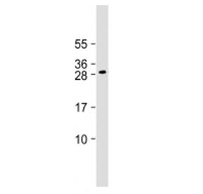 DLX1 Antibody (Center Region)