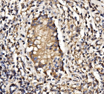 PI3-kinase subunit p85 alpha / PIK3R1