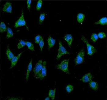 IL-2 Receptor Antibody beta subunit / IL2RB