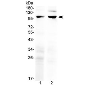 TRPC6 Antibody