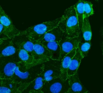 Gamma Catenin Antibody