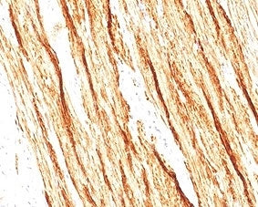 Smoothelin Antibody / SMSMO / SMTN