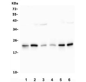 Western blot testing of 1) rat liver, 2) rat PC-12, 3) mouse liver, 4) mouse kidney, 5) mouse NIH 3T