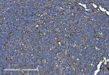 PNPT1 Antibody