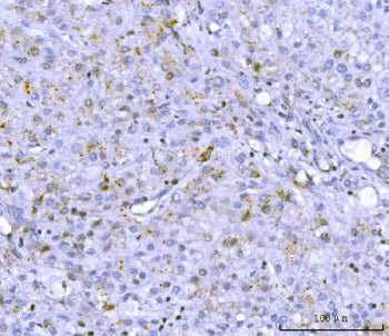 PCSK9 Antibody