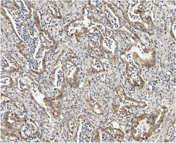 MMUT Antibody / Methylmalonyl Coenzyme A mutase