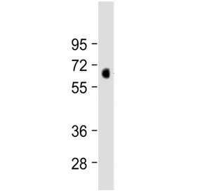 MKS1 Antibody / Meckel syndrome type 1 protein (N-Terminal Region)