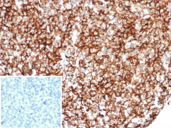 CD35 Antibody / CR1