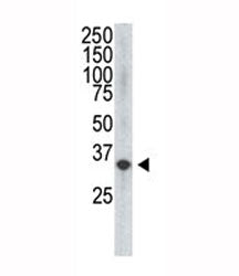 The VEGF4 antibody used in western blot to detect VEGF4 in HDMEC cell lysate. Expected molecular wei