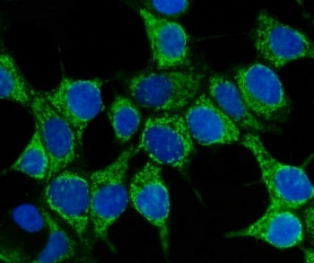 HSP70 Antibody / HSPA1A