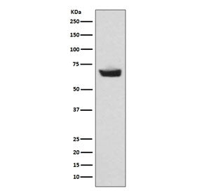 CETP Antibody / Cholesteryl Ester Transfer Protein