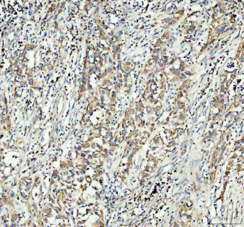 IHC testing of FFPE human testis tissue with GSTM3 antibody at 1ug/ml. Required HIER: steam section