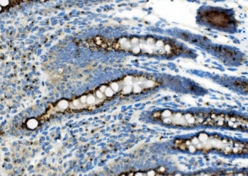 Golph2 Antibody