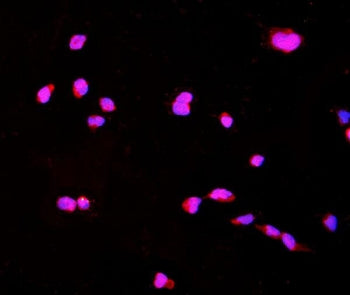 CTHRC1 Antibody