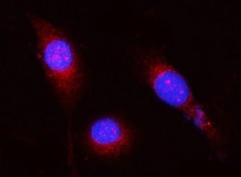 Immunofluorescent staining of FFPE human PC-3 cells with OPLAH antibody (red) and DAPI nuclear stain